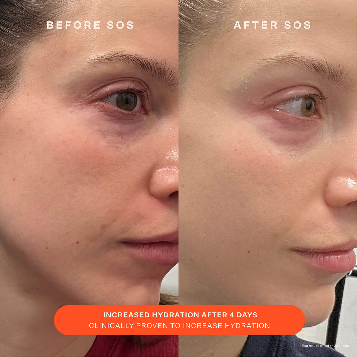 SOS Recovery Cream X8