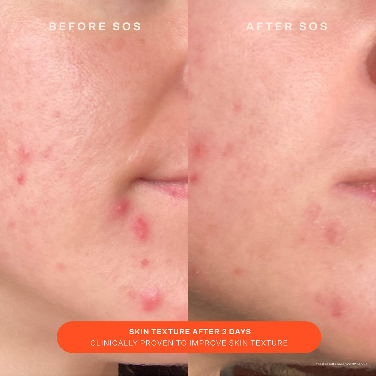 SOS Recovery Cream X8