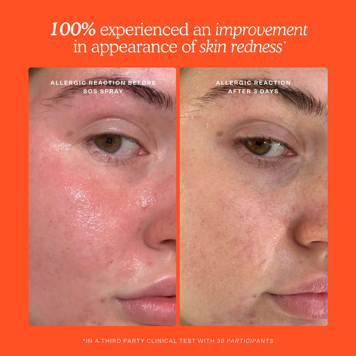 SOS Skincare Minis Kit R9