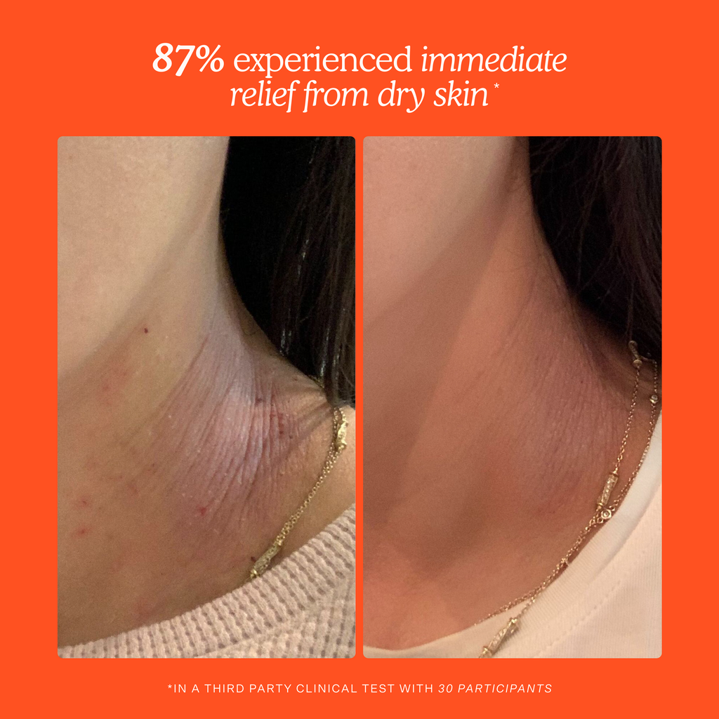 SOS Rescue Spray Refill O6