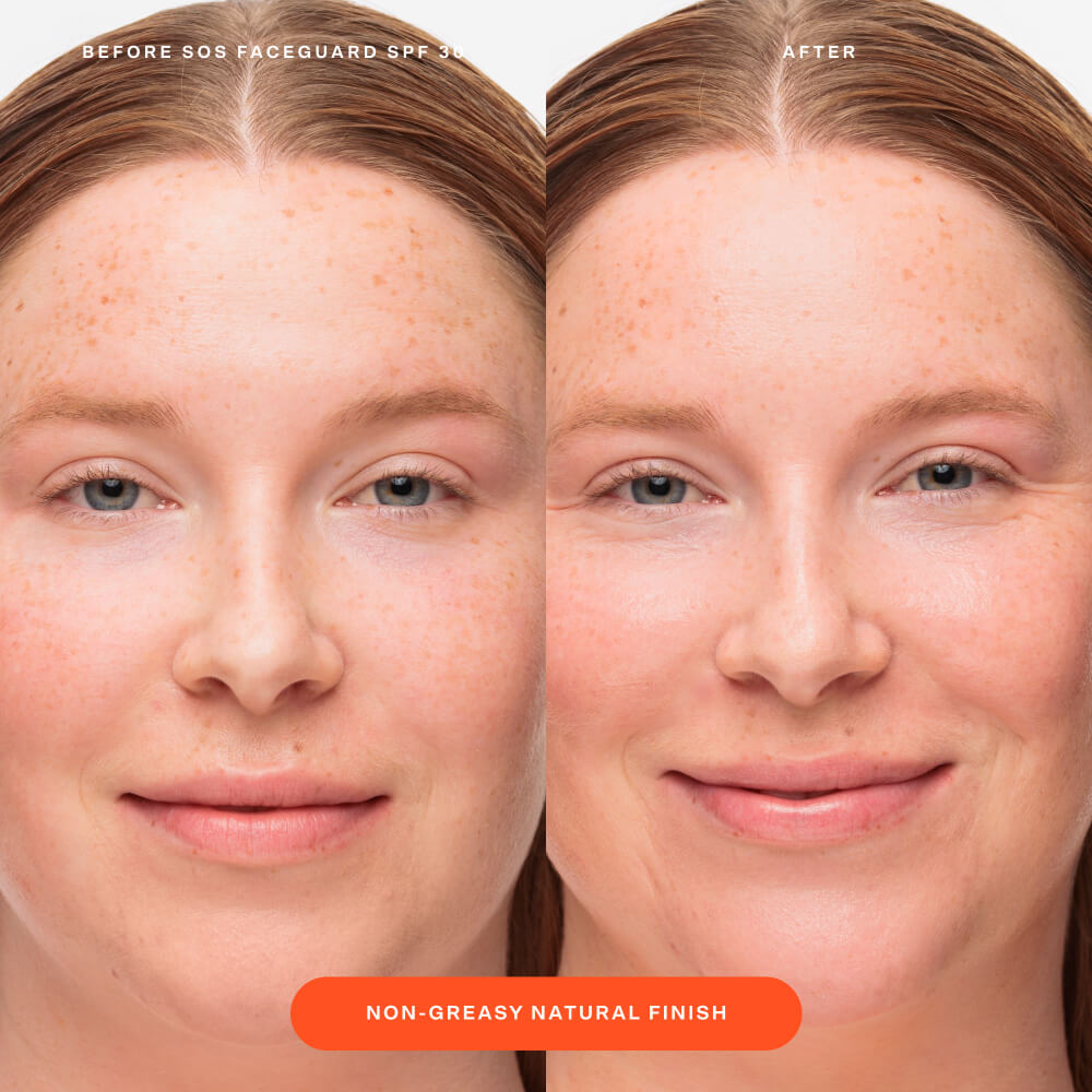 SOS FaceGuard™ SPF 30 Sunscreen PA+++ W0