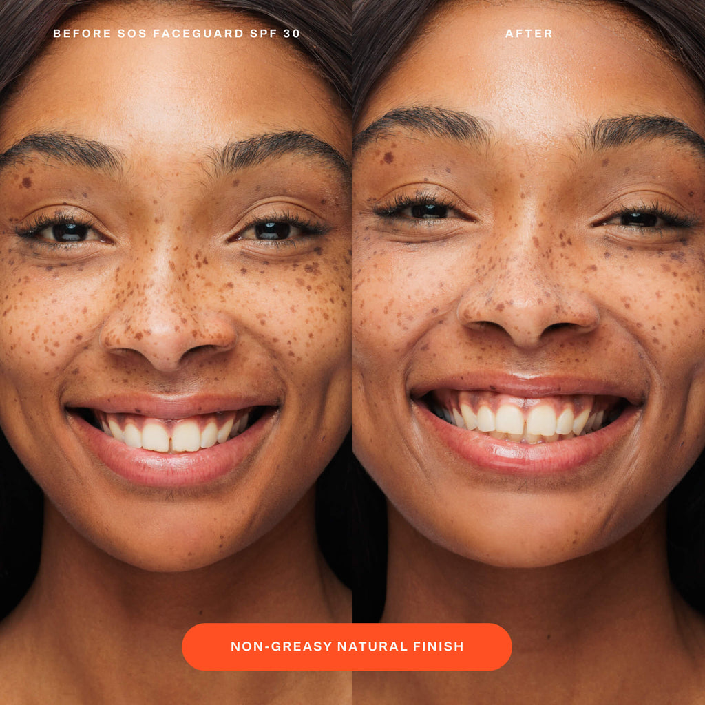 SOS FaceGuard™ SPF 30 Sunscreen PA+++ W0