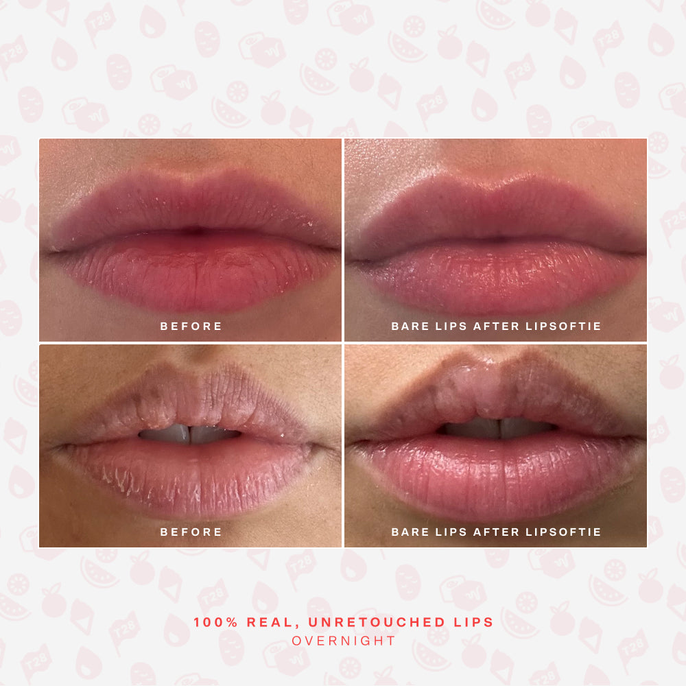 LipSoftie® Lip Treatment Set H1