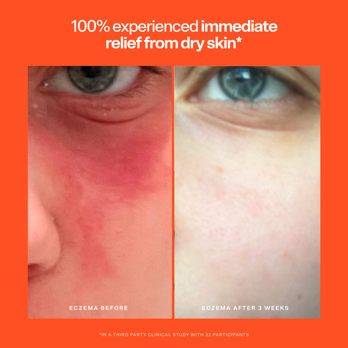 SOS Rescue Serum U3