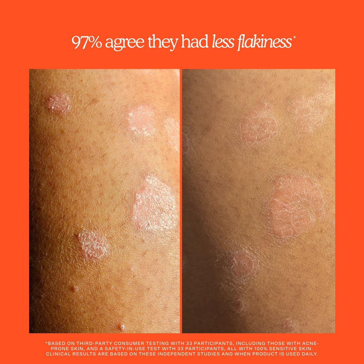 SOS Rescue + Relief Body Wash Treatment Q9